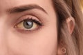 Woman with yellow eyes. Liver problems symptom