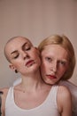 Womanlike albino man with long blonde hair holding head at the shoulder of bald masculine female Royalty Free Stock Photo