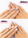 Womans hands before and after manicure correction procedure Royalty Free Stock Photo