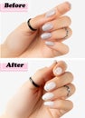 Womans hands before and after manicure correction procedure Royalty Free Stock Photo