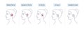 A womans head with different categories of hearing aids for the hearing impaired and the deaf.Vector flat illustration.