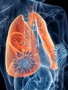 A womans lung Royalty Free Stock Photo