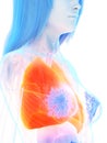 A womans lung Royalty Free Stock Photo