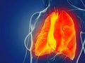 A womans lung Royalty Free Stock Photo