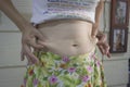 Women belly fat