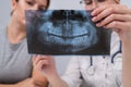 A woman doctor and a patient at the reception are discussing an x-ray of the jaw. Royalty Free Stock Photo