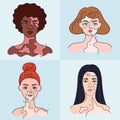 Women faces with vitiligo - vector set. Isolated girls portraits with pigment spots. Collection about diversity
