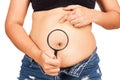 Women fat belly show stretch marks