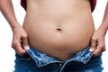 Women with fat belly and stretch marks Royalty Free Stock Photo