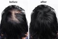 Women hair after using cosmetic powder for thickening. Before and after Royalty Free Stock Photo