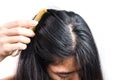 Women head with dandruff Caused by the problem of dirty. Or caused by skin disease or Seborrheic Dermatitis. It has white scaly an Royalty Free Stock Photo