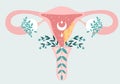 Women health - Oncology. Anatomical scheme of Carcinoma - or other Gynecological cancer tumor with metastases