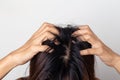 Women itching scalp damaged hair, Haircare concept Royalty Free Stock Photo
