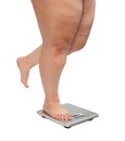 Women legs with overweight