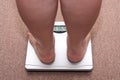 Women legs with overweight Royalty Free Stock Photo