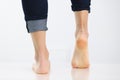 Women legs and raised heel. Problem skin on the feet Royalty Free Stock Photo