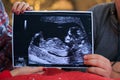 Women and man holding ultrasound picture of they future baby in arms Christmas tree background. Concept photo of pregnancy, Royalty Free Stock Photo