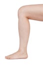 Women's leg, bent at the knee
