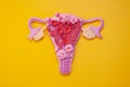 The women`s reproductive system. The concept of endometriosis of the uterus