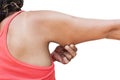 Women show fat and scratch mark , wrinkle of armpit Royalty Free Stock Photo