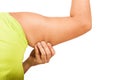 Women show fat wrinkle of armpit Royalty Free Stock Photo