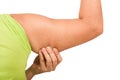 Women show fat wrinkle of armpit Royalty Free Stock Photo