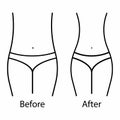 Women waist, weight loss. Weight training and Healthy Eating. Body - before and after. White background. Vector illustration