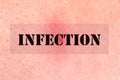 Infection Concept Word