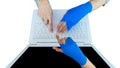 work injury. injured woman hand sore with blue elastic bandage o