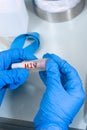 Gloved hand holding test tube with blood label indicating HIV test Royalty Free Stock Photo
