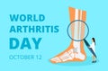 World arthritis day in October. Tiny doctors treat rheumatism, osteoarthritis. Healthcare flat concept vector