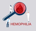 World Hemophilia Day concept. Coagulation and blood clotting problem. Magnifier with cancer blood full of cells.