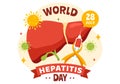 World Hepatitis Day Vector Illustration on 28 July of Patient Diseased Liver, Cancer and Cirrhosis in Healthcare Flat Cartoon Royalty Free Stock Photo