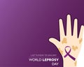 World Leprosy Day observed on last Sunday of January every year