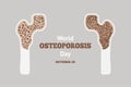 World Osteoporosis Day. Osteoarthritis of human anatomical bones. Information poster about diseases of bone system and