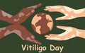 World Vitiligo Day poster. Hands of different nationalities with skin diseases. Human solidarity.