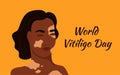 World vitiligo day. Poster, leaflet, banner. Royalty Free Stock Photo