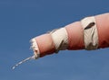 Worn-out windsock 2