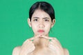 Worried stressed young Asian woman touching her skin face with finger and looking acne problem over green isolated background. Royalty Free Stock Photo