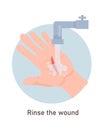 Wounds First Aid With Water