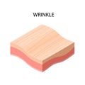 Wrinkle formation cross-section of human skin layers structure skincare medical concept flat Royalty Free Stock Photo