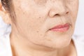 Close up skin wrinkle and freckles of old asian woman face Royalty Free Stock Photo