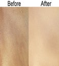 Wrinkle skin before and after treatment effect difference Royalty Free Stock Photo