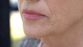 Wrinkled face of elderly woman, cosmetological injections, plastic surgery Royalty Free Stock Photo