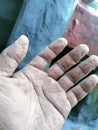 Wrinkled Hands Exposed to Water for Too Long