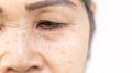 Wrinkled of old asian woman skin eyelid Royalty Free Stock Photo