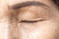 Wrinkled of old asian woman skin eyelid Royalty Free Stock Photo