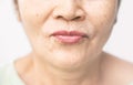 Wrinkled of old asian woman skin Royalty Free Stock Photo