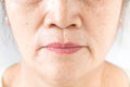 Wrinkled of old asian woman skin Royalty Free Stock Photo