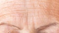 Wrinkled skin of a mature woman`s forehead macro photography. Deep aging wrinkles close up. Prevention of age-related skin change